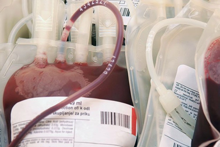 کشف روشی برای تبدیل هر نوع خون اهدایی به نوع عمومی