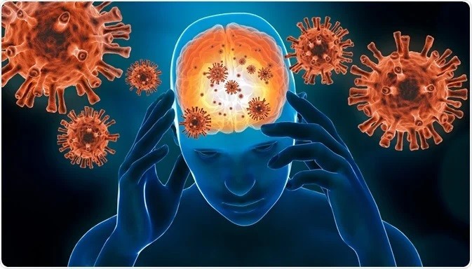 ویروس کرونا می تواند منجر به فراموشی، روان پریشی، شیدایی و لکنت زبان شود